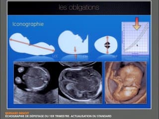 échographie de dépistage du 1er trimestre. Actualisation du standard