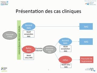 variabilité de la décision d'IMG en cas d'anomalie des chromosomes sexuels au sein des CPDPN  d'ile de France