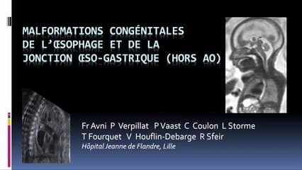 Œsophage : duplication, reflux, kyste, hernie…