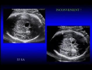 En pratique : pourquoi et comment s’intéresser à la gyration ?
