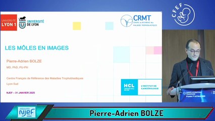 Les môles en image