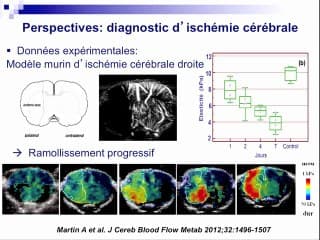 Elastographie ultrasonore du nouveau-né. Existe-t-il une application en anténatal ?