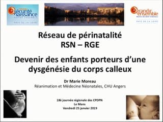 Devenir des enfants porteurs d’une dysgénésie du corps calleux.