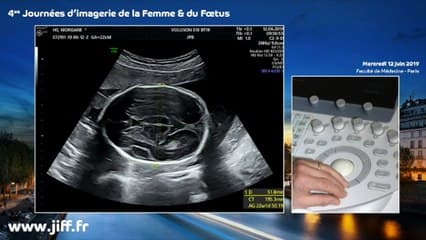 SYSTÈME NERVEUX CENTRAL démo live Les recommandations de la CNÉOF