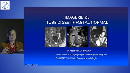 Tube digestif : de la physiologie à l’imagerie