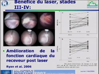 Anasarque et syndrome transfuseur-transfusé