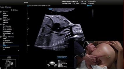 Démonstration live : Le thorax.