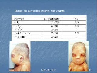 Hyper-clarté nucale précoce et persistante trisomie 22
