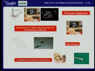 AMP, DAN et les femmes à risque infectieux