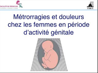 Métrorragies et douleurs chez les femmes en période d’activité génitale Lorsque les ß-hCG sont positives (aménorrhée < 9 SA