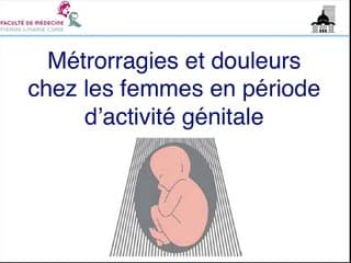 Métrorragies et douleurs chez les femmes en période d’activité génitale Lorsque les ß-hCG sont positives (aménorrhée < 9 SA