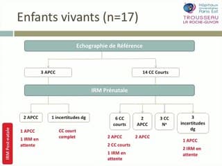Diagnostic prénatal des corps calleux courts.
