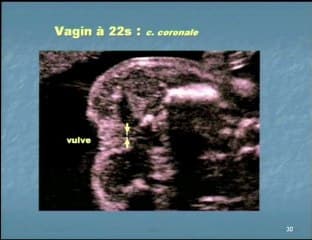 Rectum, vagin et urètre masculin : nouveautés échographiques.