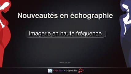 Nouveautés en échographie: les hautes fréquences