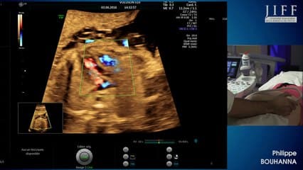 atelier : l'échographie du 2eme trim