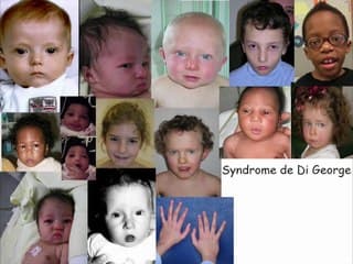 Coeur : du signe au syndrome, du syndrome à la génétique