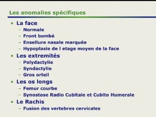 craniostenose syndromique