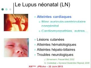 Que doit-on chercher chez le foetus lorsque la patiente est malade ? Lupus et maladies de système