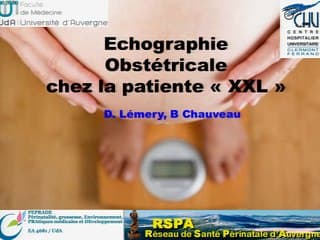 Echographie obstétricale des patientes XXL