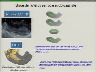 État actuel des recommandations internationales sur le compte rendu échographique de l'examen gynécologique