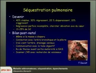 Maladie adénomateuse, séquestration, épanchements