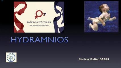 Hydramnios