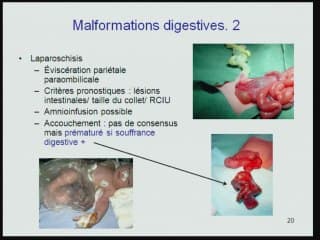 quel terme pour quelle malformation ?