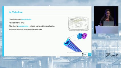 Imagerie prénatale des tubulinopathies avec focus sur les diagnostics différentiels d’un tronc cérébral en «Z»