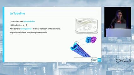 Imagerie prénatale des tubulinopathies avec focus sur les diagnostics différentiels d’un tronc cérébral en «Z»