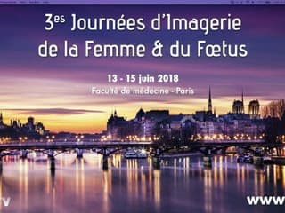 Bilan de l’utérus*› adénomyose endometriose