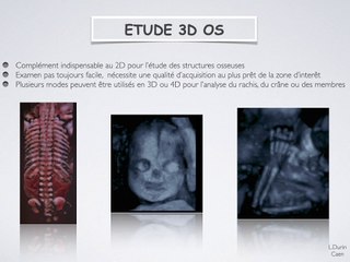 POSTER 3D Os