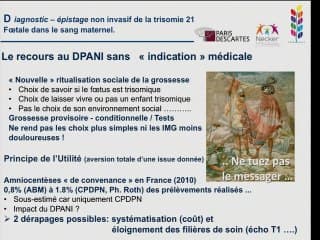 Le dépistage avancé non invasif de la trisomie 21 foetale Les questionnements éthiques soulevés par le DPANI de la trisomie 21