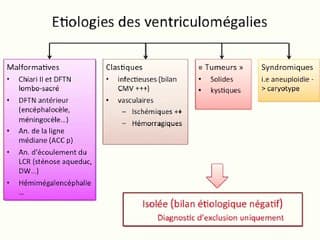 Nouvelle approche structurée des ventriculomégalies « isolées »