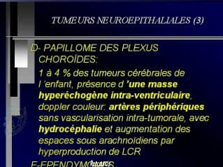 Les tumeurs cérébrales : littérature