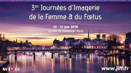 Bilan de l’homme* › L’échographie testiculaire et des autres organes génitaux masculins, quand les prescrire ?