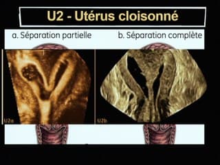 Place de l'image frontale obtenue en 3D