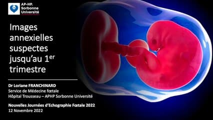 Images annexielles suspectes jusqu’au 1er trimestre