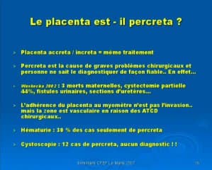 Placenta accreta