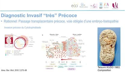 Infection materno-foetales : du diagnostic au retentissement foetal