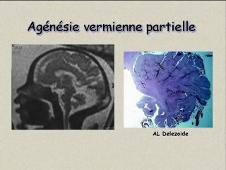 Et pourtant, il tourne. Le vermis