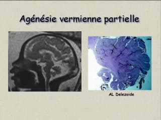 Et pourtant, il tourne. Le vermis