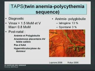 Le Doppler des jumeaux