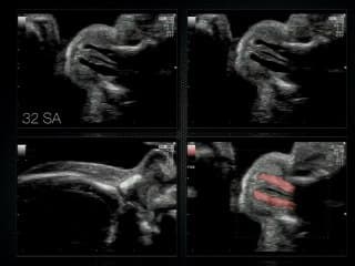 La haute fréquence en exploration de la face