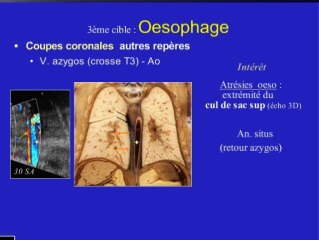 Aspects échographiques normaux de l'appareil digestif foetal