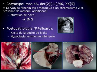 Les aspects pathologiques du cervelet