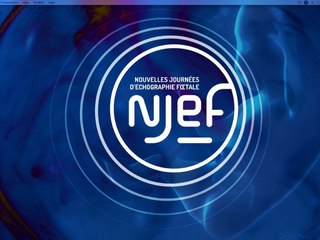 Le col au 2ème trimestre : intérêt de la mesure pour le risque de prématurité (anglais)