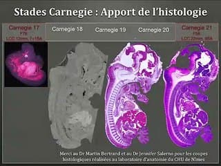 Modélisation tridimensionnelle par micro imagerie multimodale (CT et IRM) du fœtus humain dans le cadre du Projet FETTAL