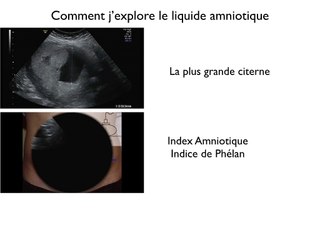 POSTER LA