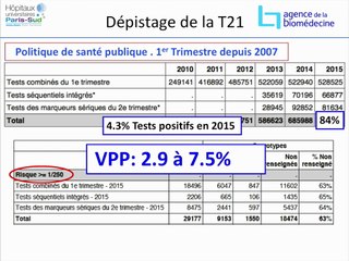ADN FOETAL LIBRE CIRCULANT EN POPULATION GÉNÉRALE : ÉTUDE DEPOSA