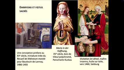 Les imageries du foetus, entre art et société, du Moyen-Age à l’époque contemporaine